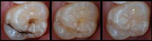 Children Dentistry