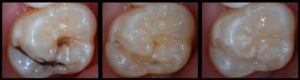 Children Dentistry