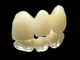 Ceramic Crowns