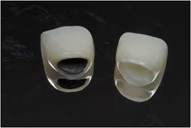 Ceramic Crowns